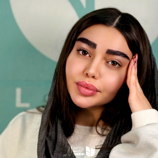 کاشت ابرو بعد از یکسال
