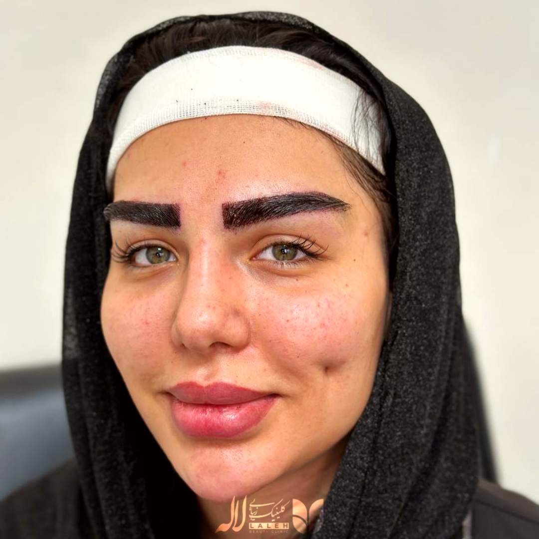 میکرو کاشت کلینیک لاله