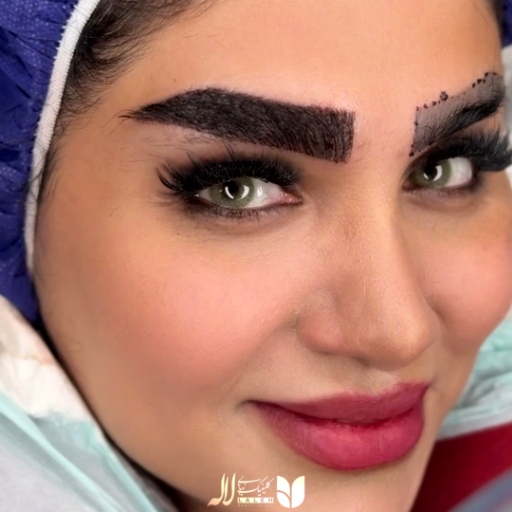 عکس کاشت ابرو پر