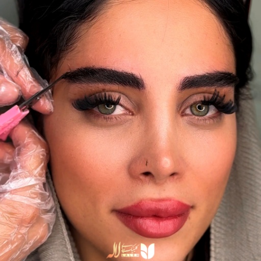 بهترین کلینیک کاشت ابرو
