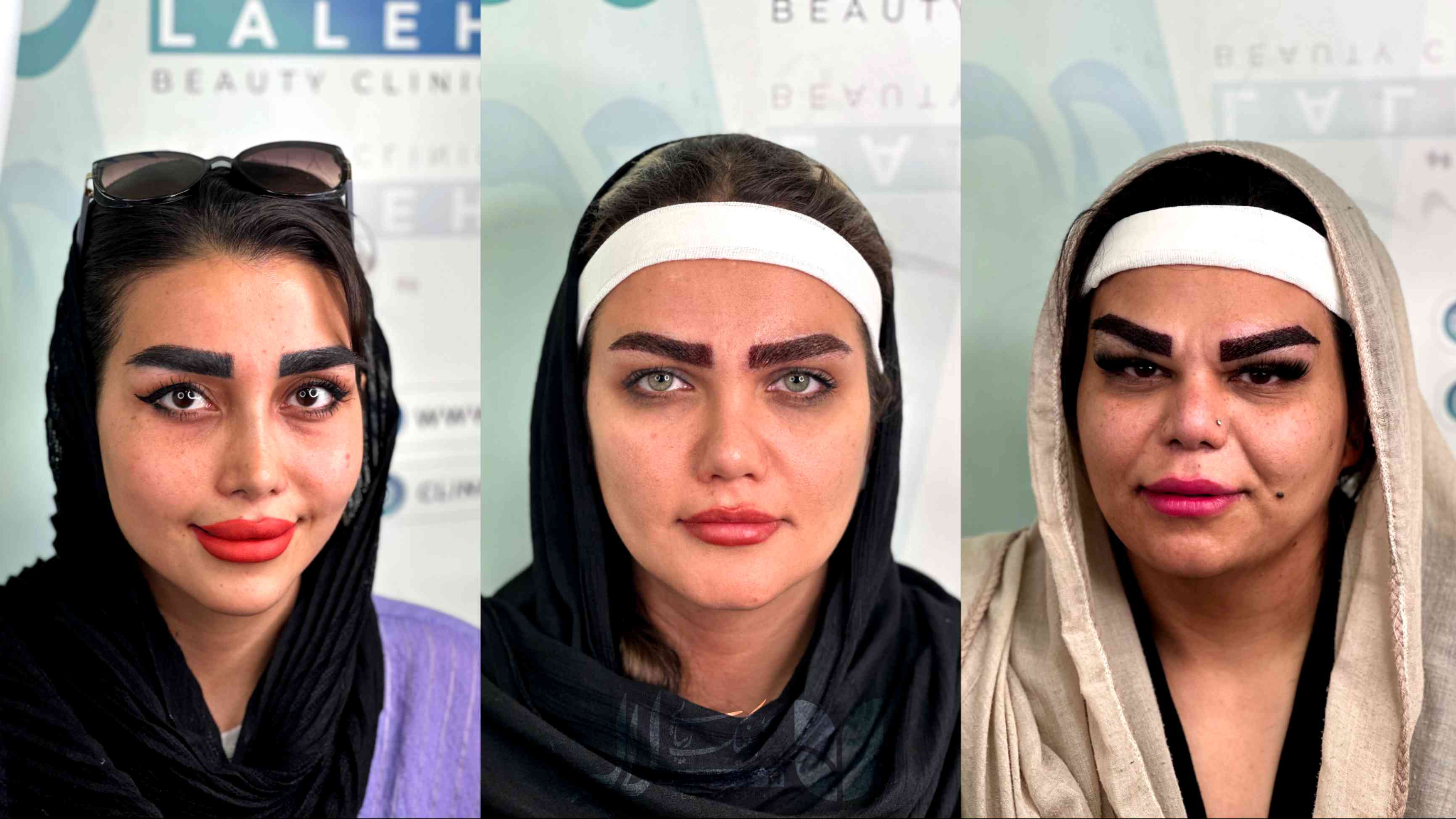 کاشت ابرو کلینیک لاله