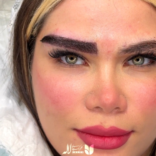 عکس کاشت ابرو لیفت