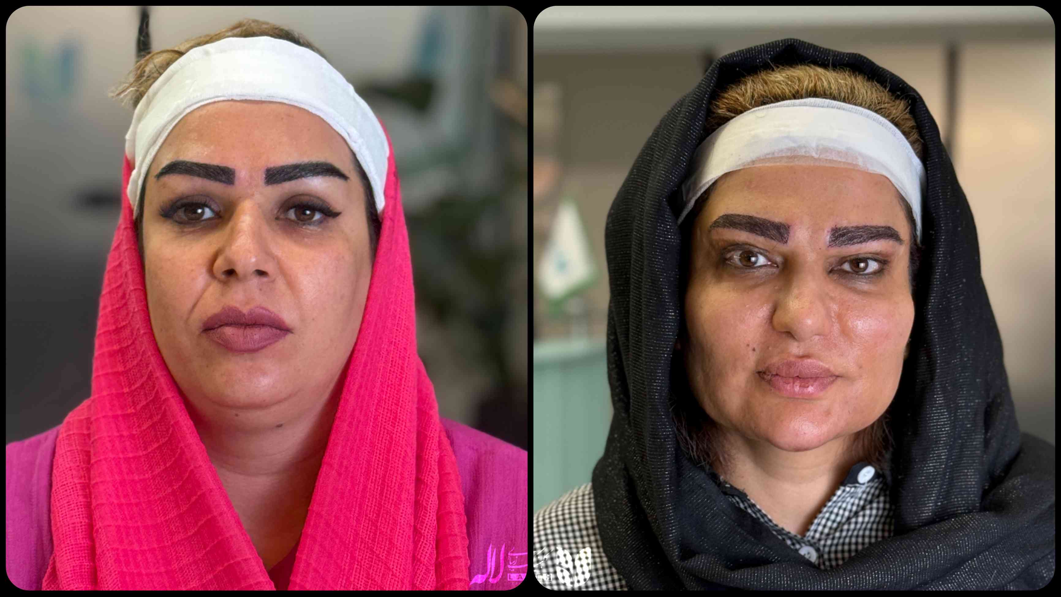 میکرو کاشت کلینیک لاله