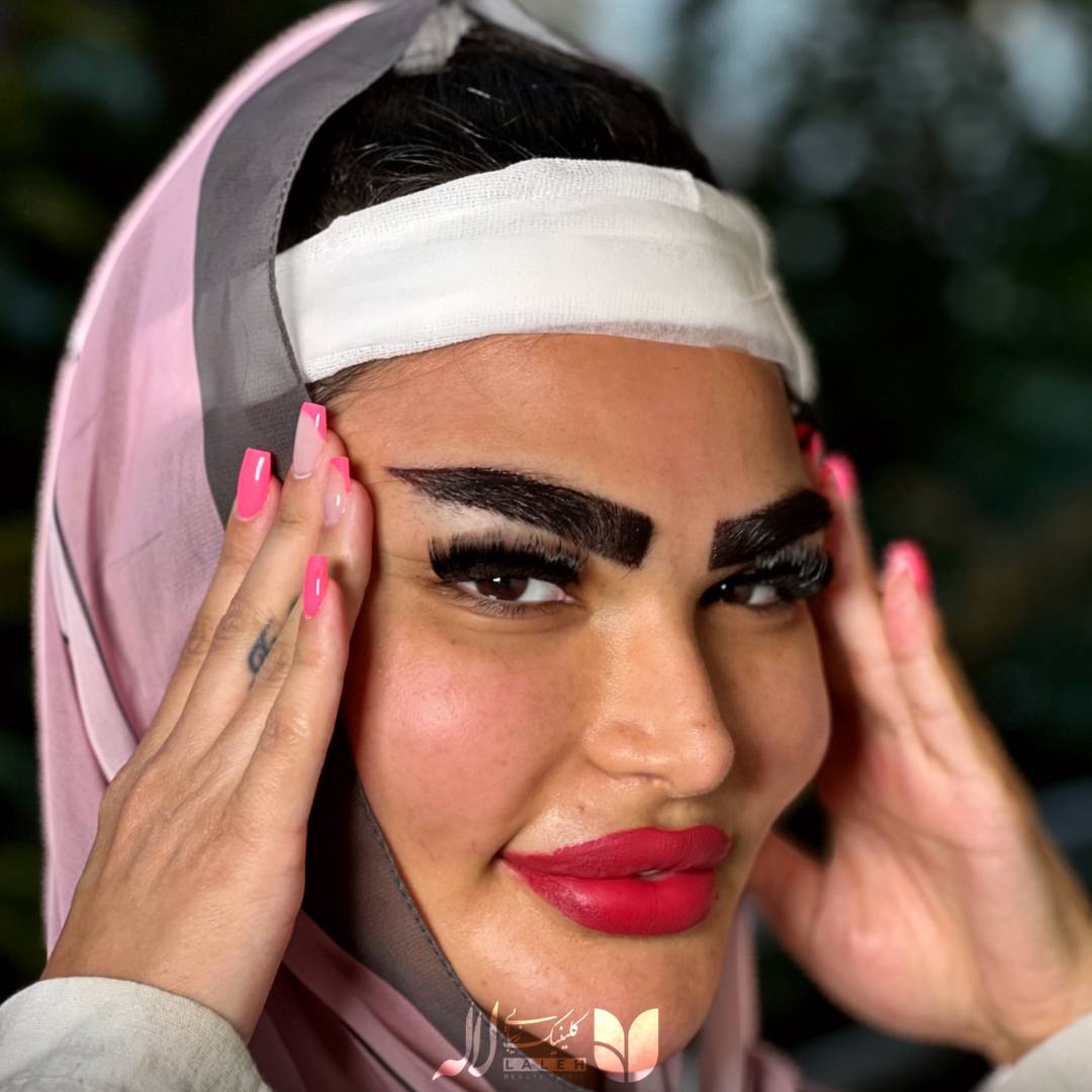 عکس مدل کاشت ابرو لیفت