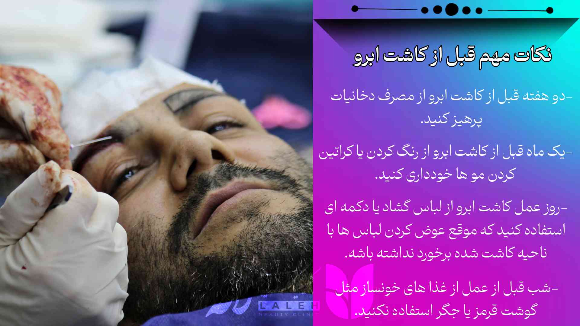 نکات مهم قبل از کاشت ابرو