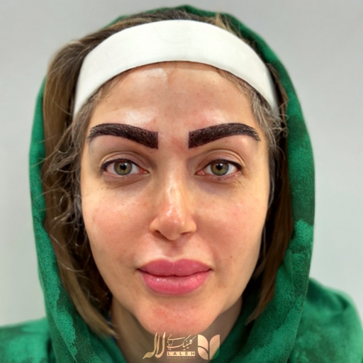 مدل ابرو برای صورت مربع