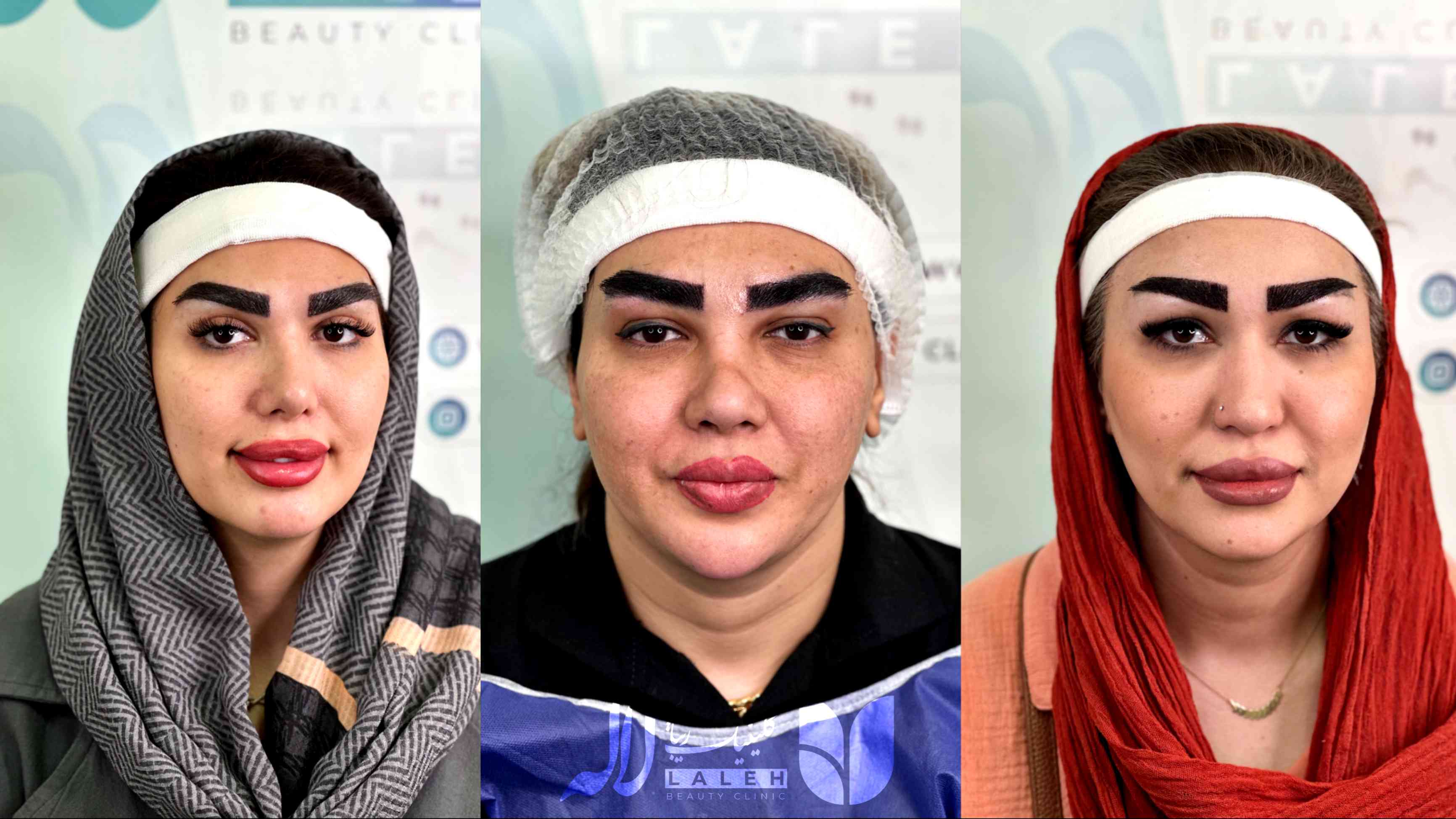 علت ریزش ابرو و راه های درمان