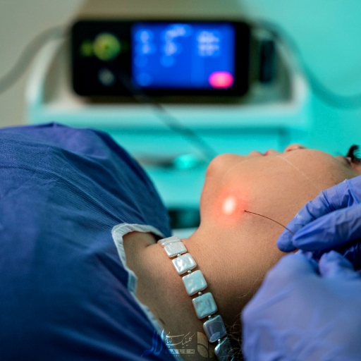 عکس اندولیفت