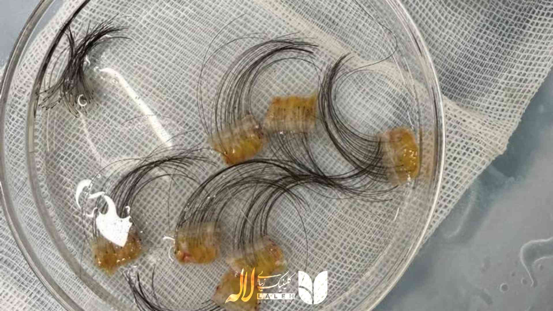تصویر موهای برداشت شده برای کاشت ابرو