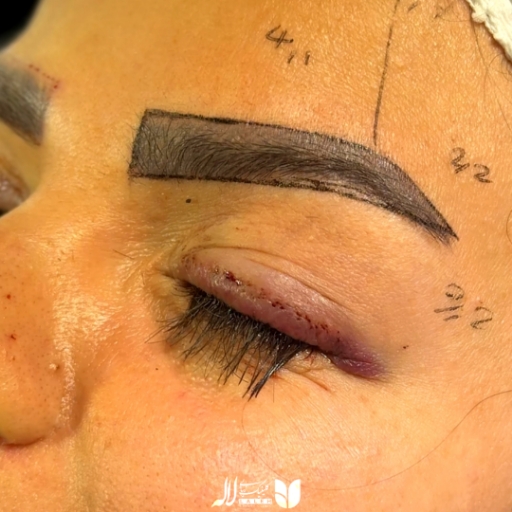 مراقبت قبل از کاشت مژه