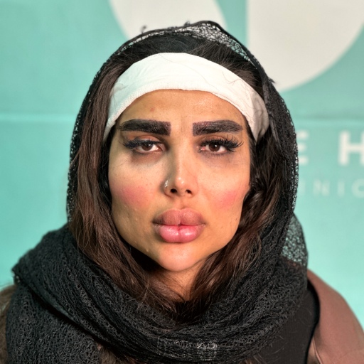 فرم ابرو برای صورت قلبی