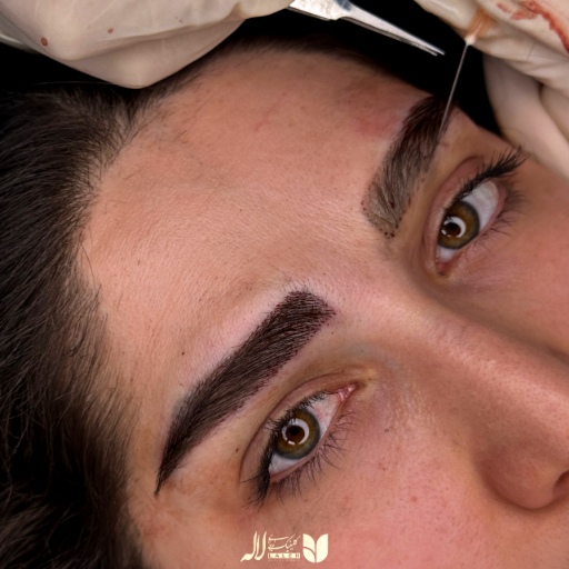 چطور بهترین نتیجه رو از کاشت ابرو بگیریم؟