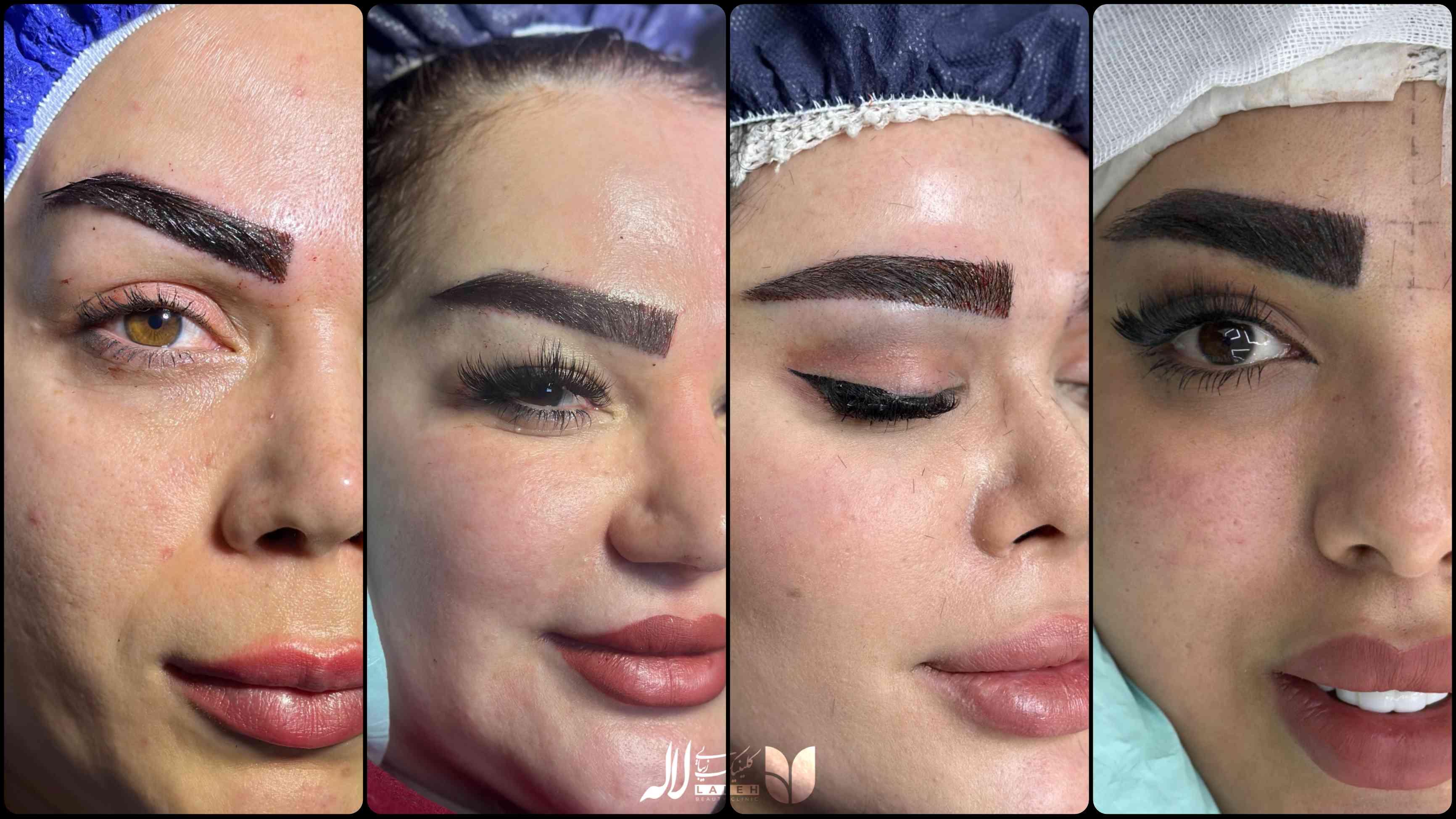 مدل جدید ابرو برای کاشت
