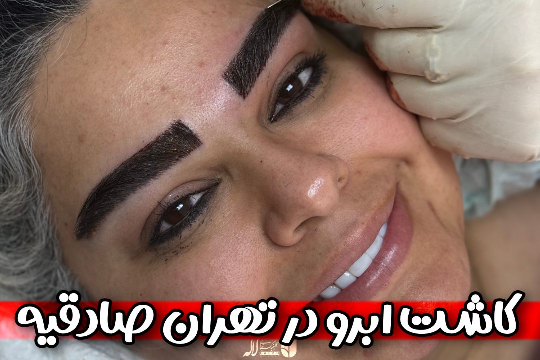 کاشت ابرو صادقیه تهران | بهترین کلینیک کاشت ابرو غرب تهران ۱۴۰۵
