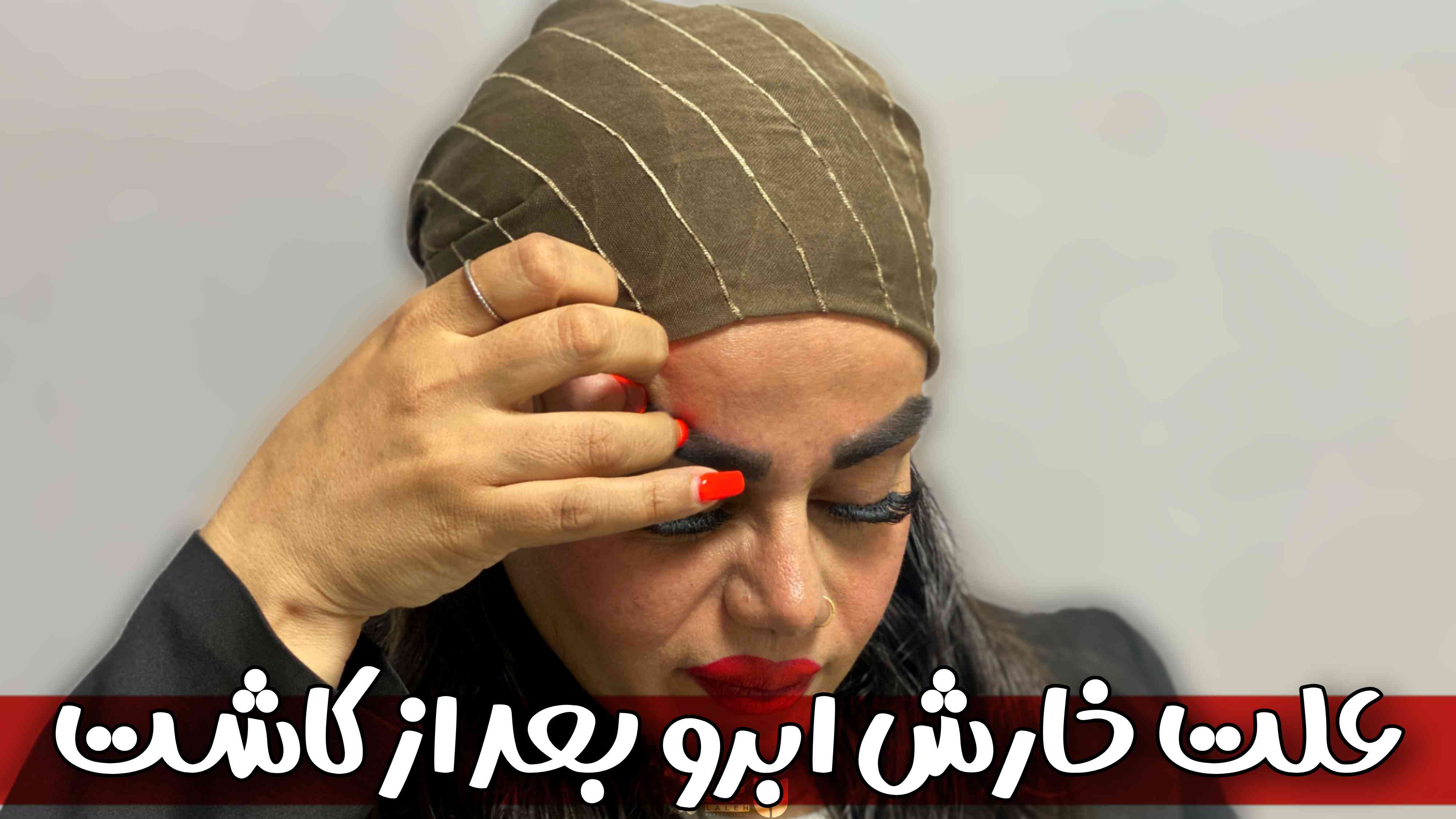 خارش ابرو بعد از کاشت - علت و درمان