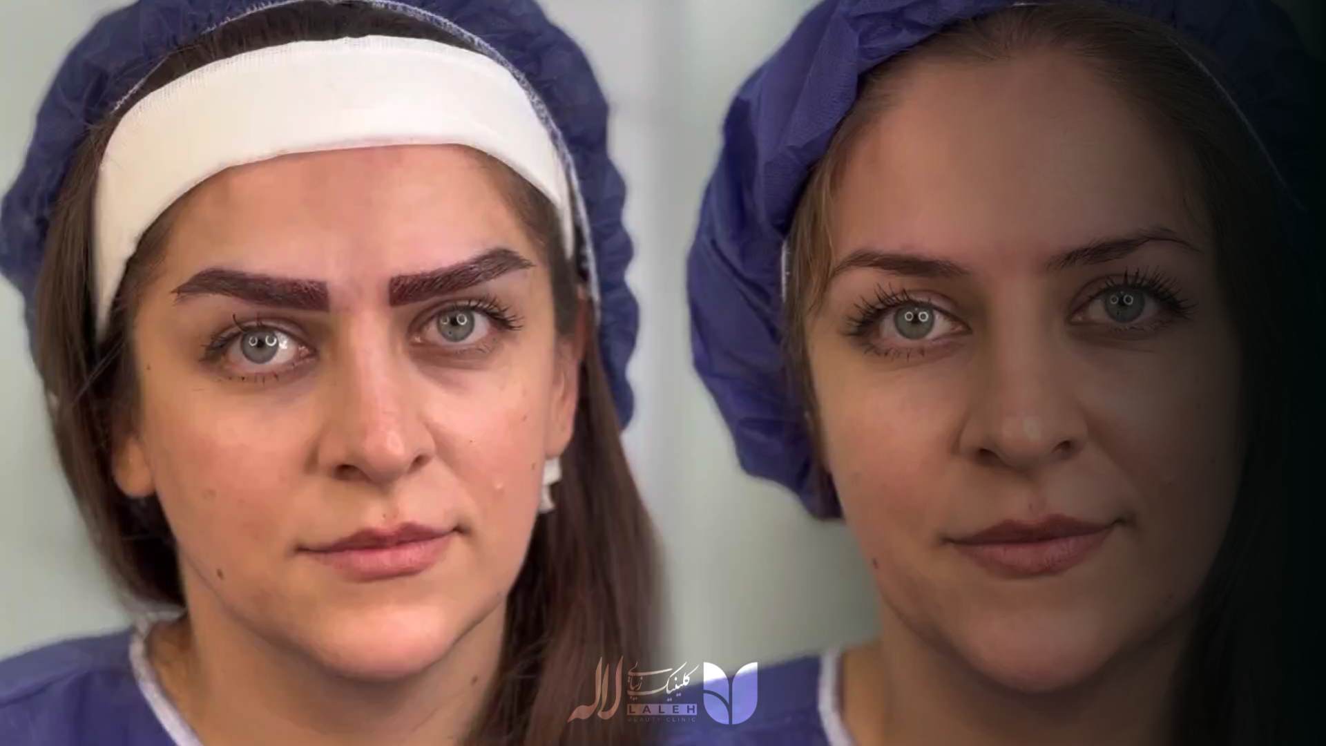 کاشت ابرو حرام است؟ - برسی نظر مراجع