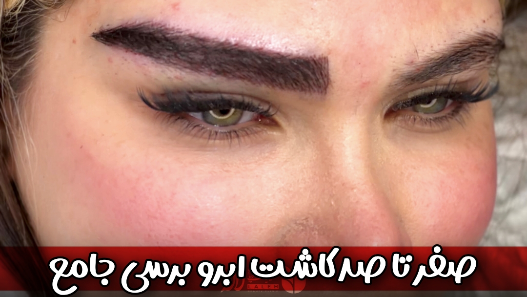 صفر تا صد کاشت ابرو | کاشت ابرو چیست و چرا اینقدر محبوب شده؟