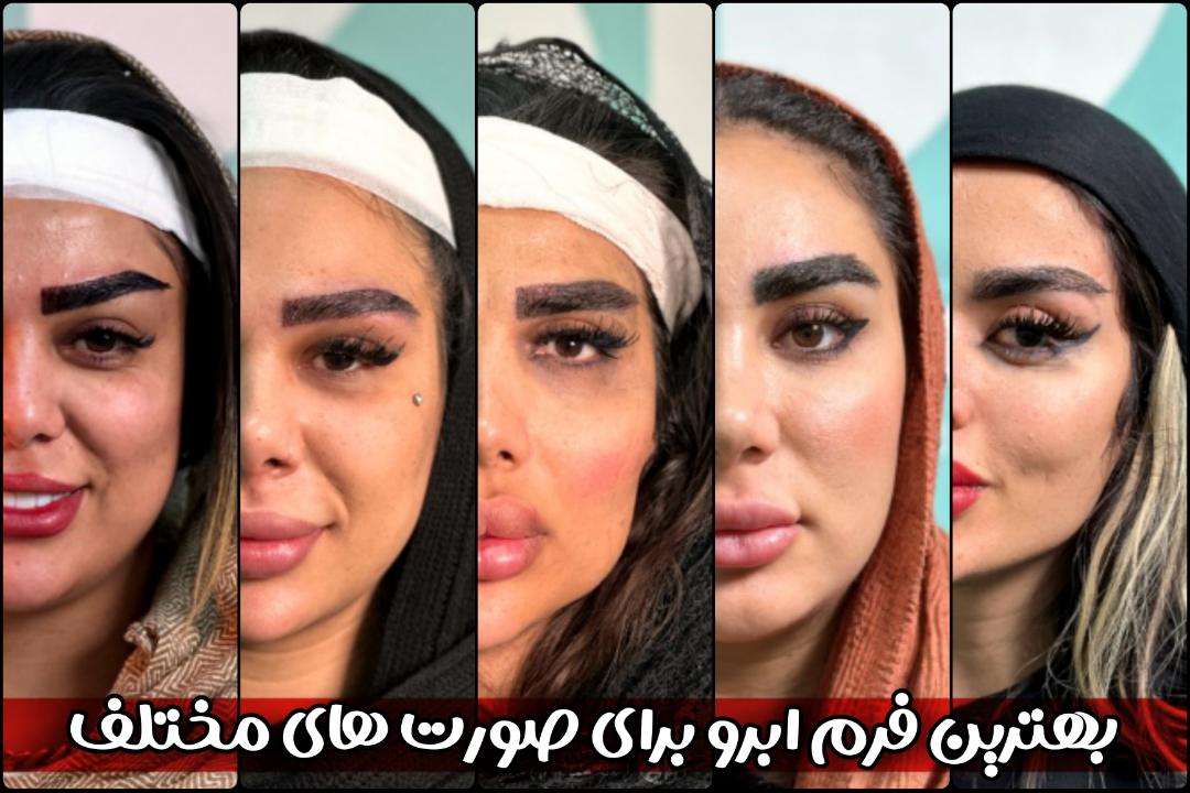 بهترین فرم ابرو برای صورت‌های مختلف | انتخاب مدل ابرو مخصوص صورتت