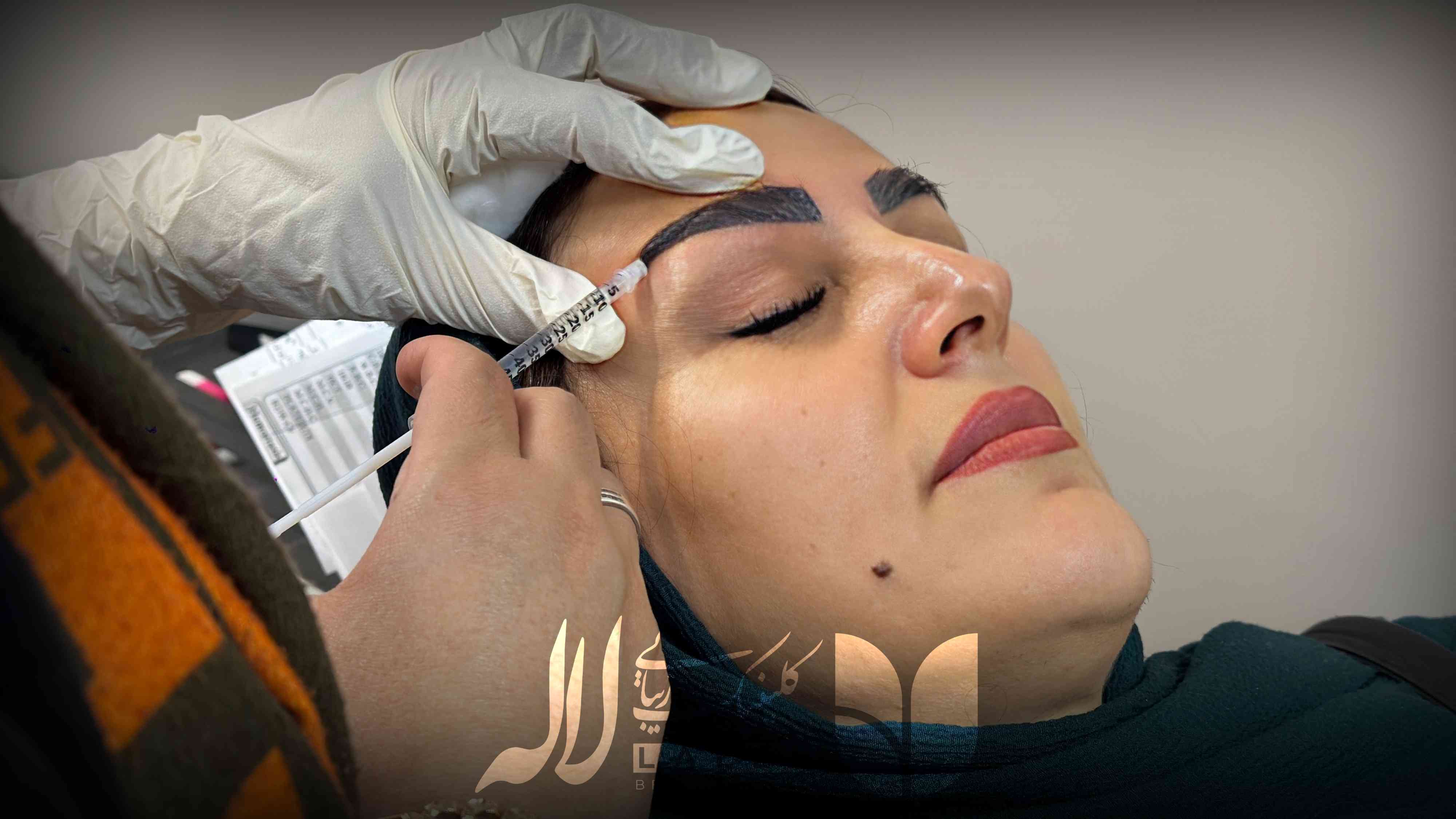 تاثیر مزو بعد از کاشت ابرو - چند جلسه مزو بعد کاشت لازمه؟