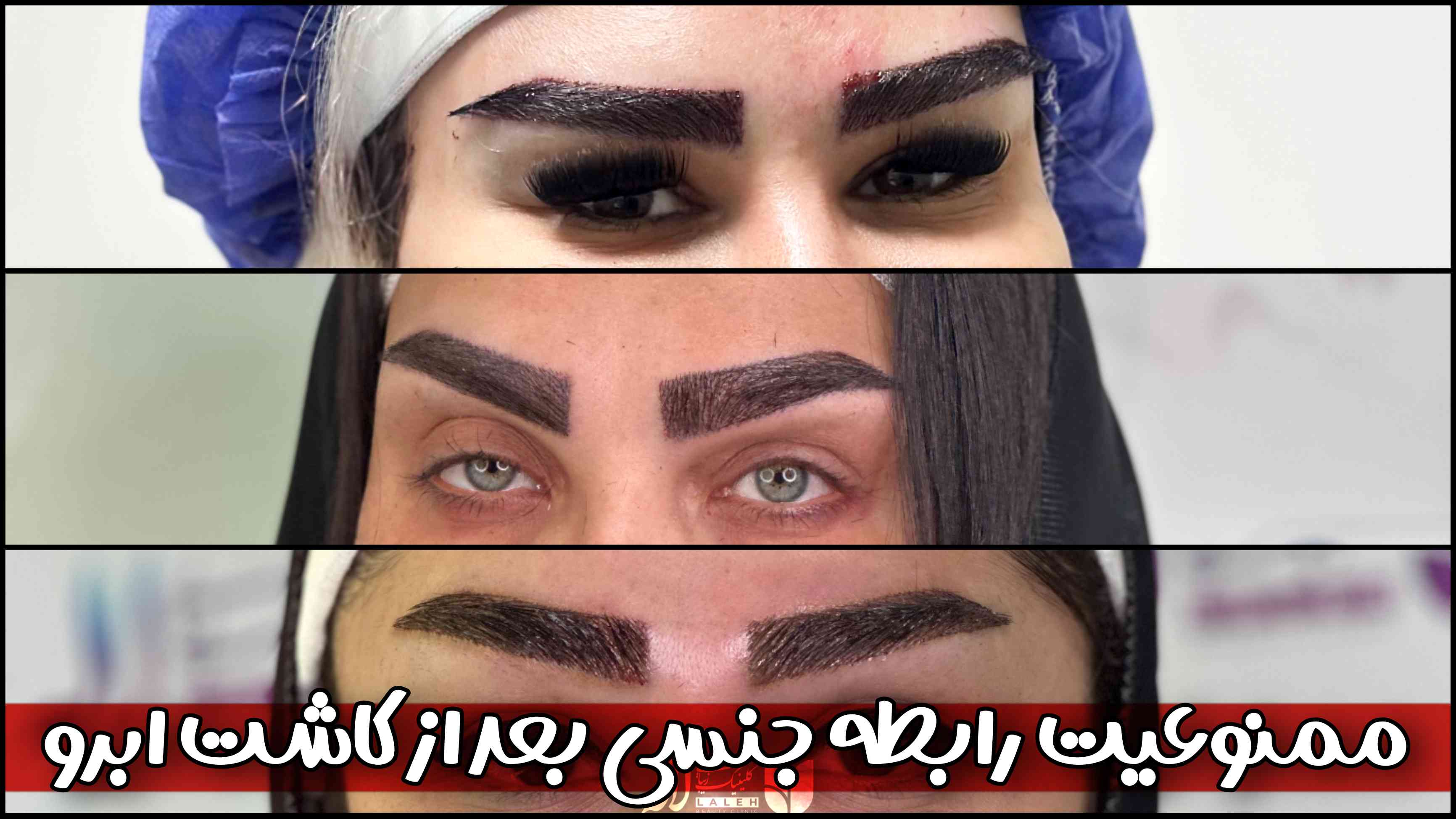 رابطه جنسی بعد از کاشت ابرو - چرا نباید بعد از کاشت رابطه داشت؟