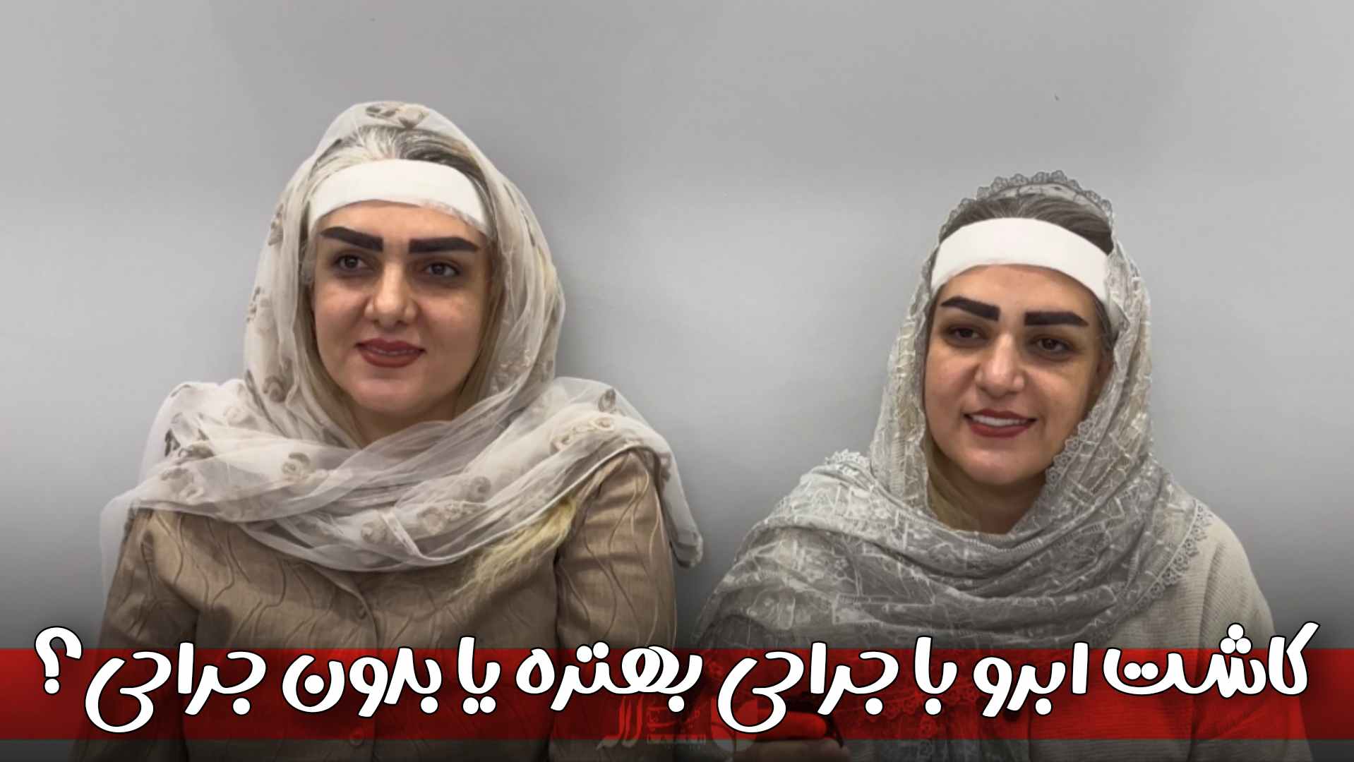 کاشت ابرو با جراحی بهتر است یا بدون جراحی