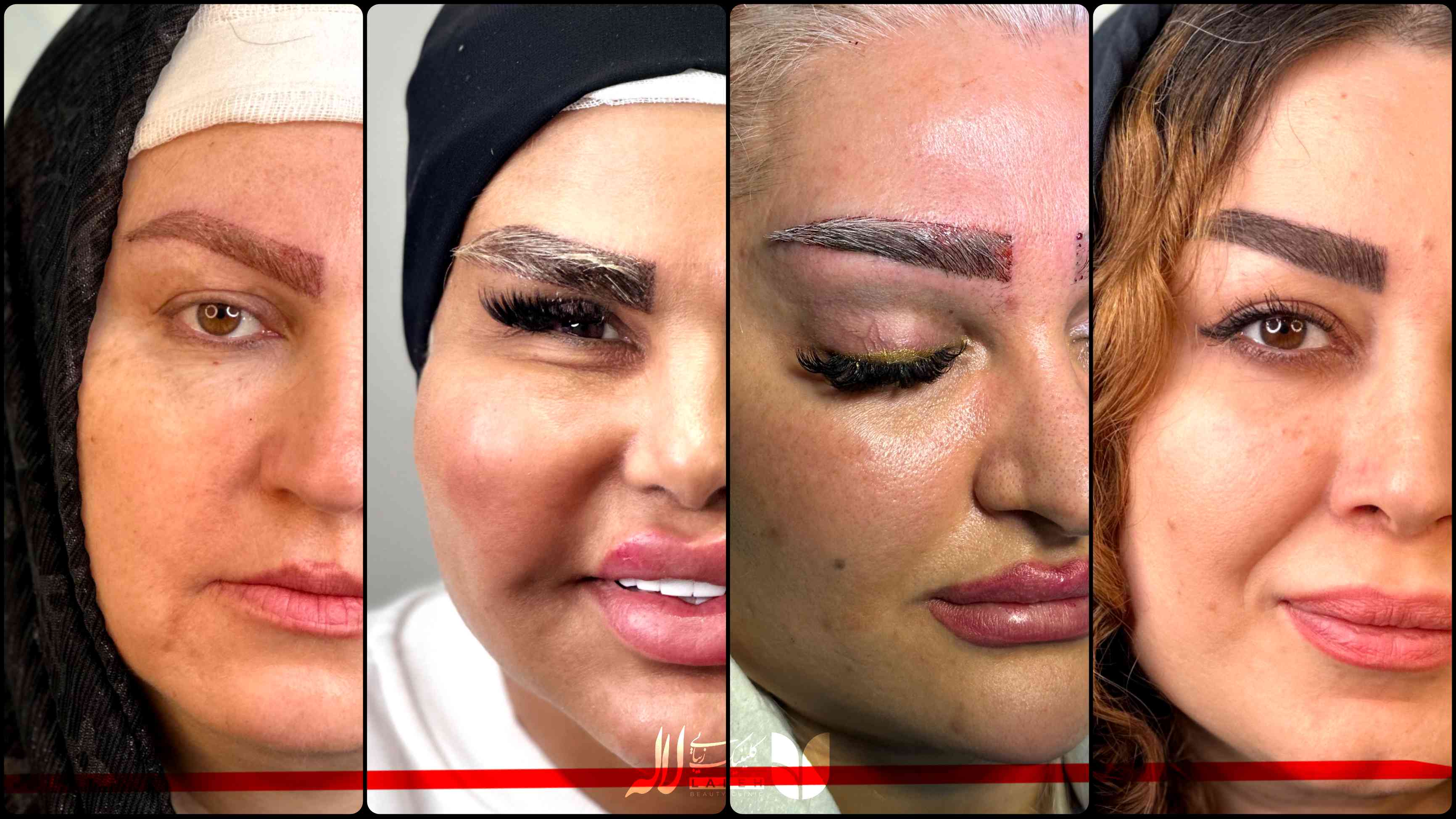 رنگ کردن ابرو بعد از کاشت