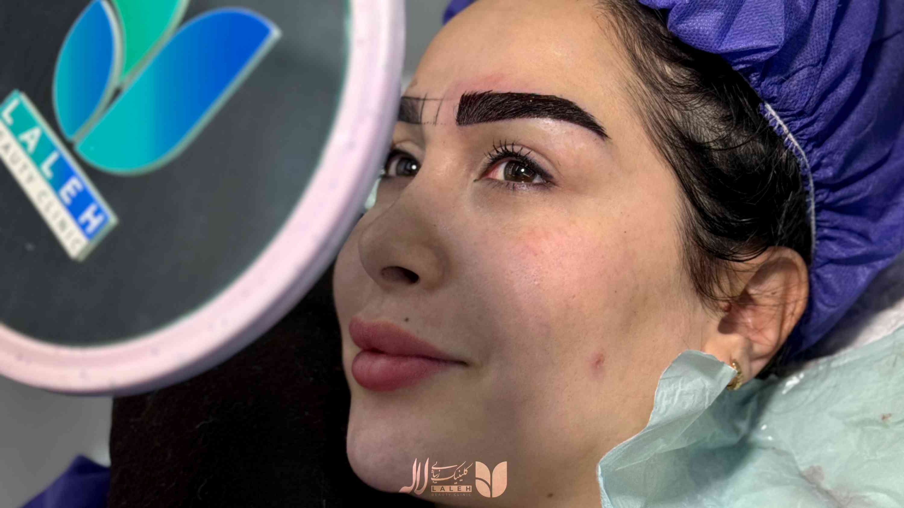 چرا ابروهای کاشته شده من رشد نمی‌ کنند؟