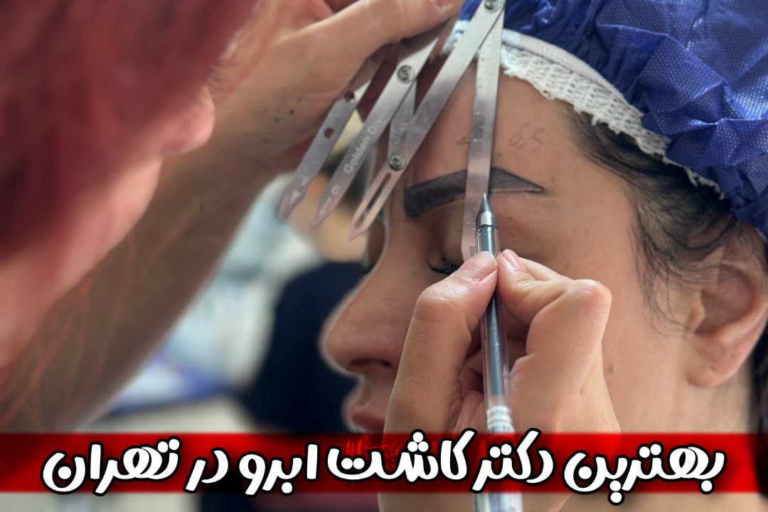 بهترین دکتر کاشت ابرو در تهران کیست؟ (معیارهای انتخاب)