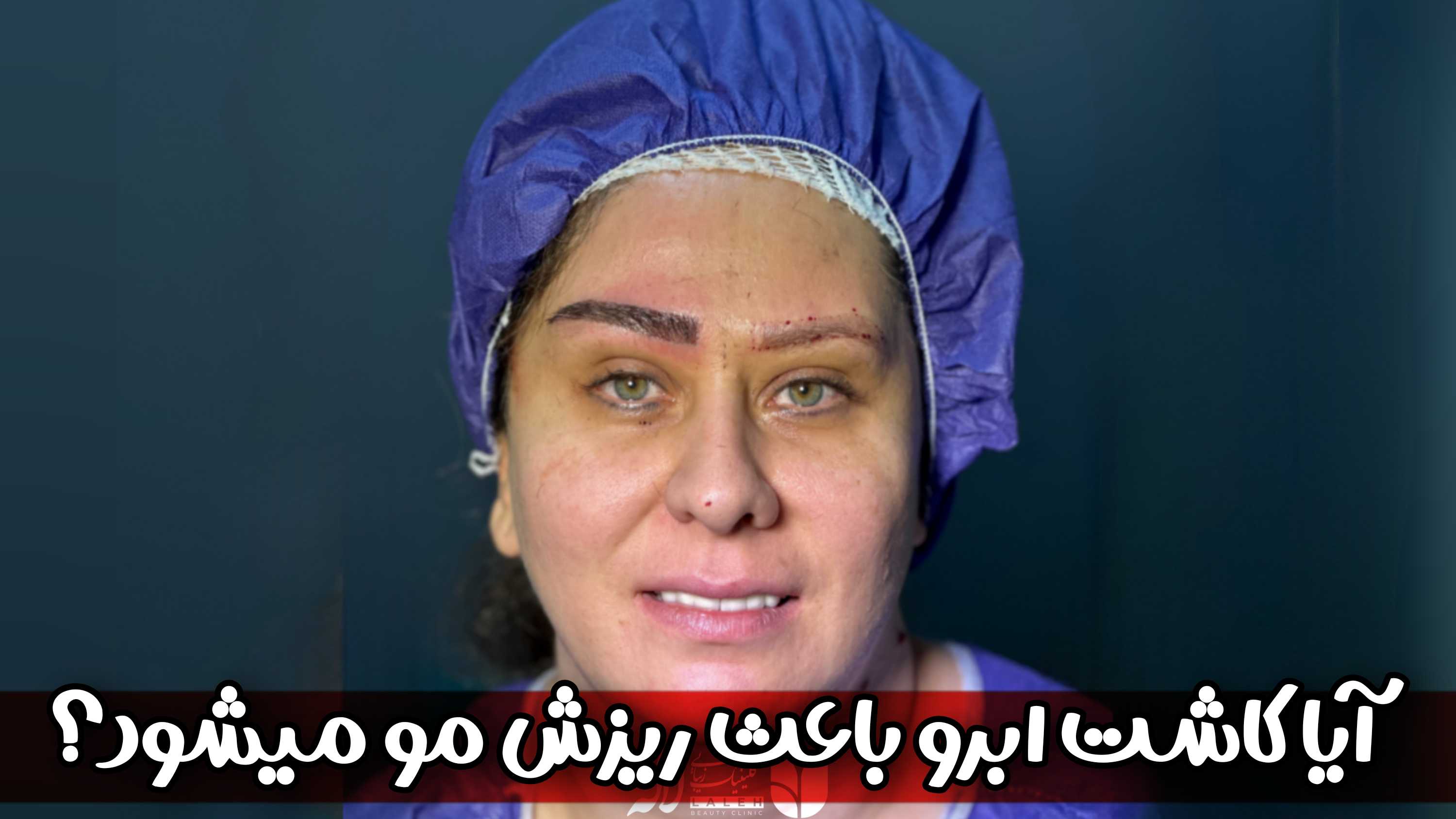 کاشت ابرو باعث ریزش مو میشود؟ - نگاه کلی به عوارض کاشت ابرو