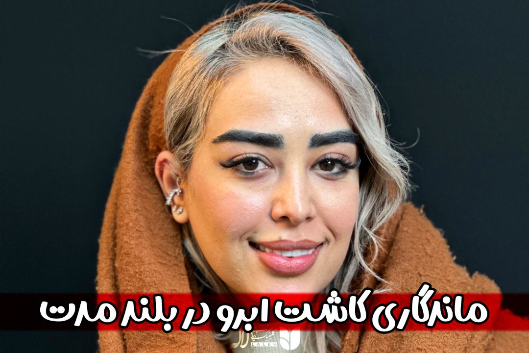 ماندگاری کاشت ابرو در بلندمدت؛ ۵ سال بعد نگران باشیم؟