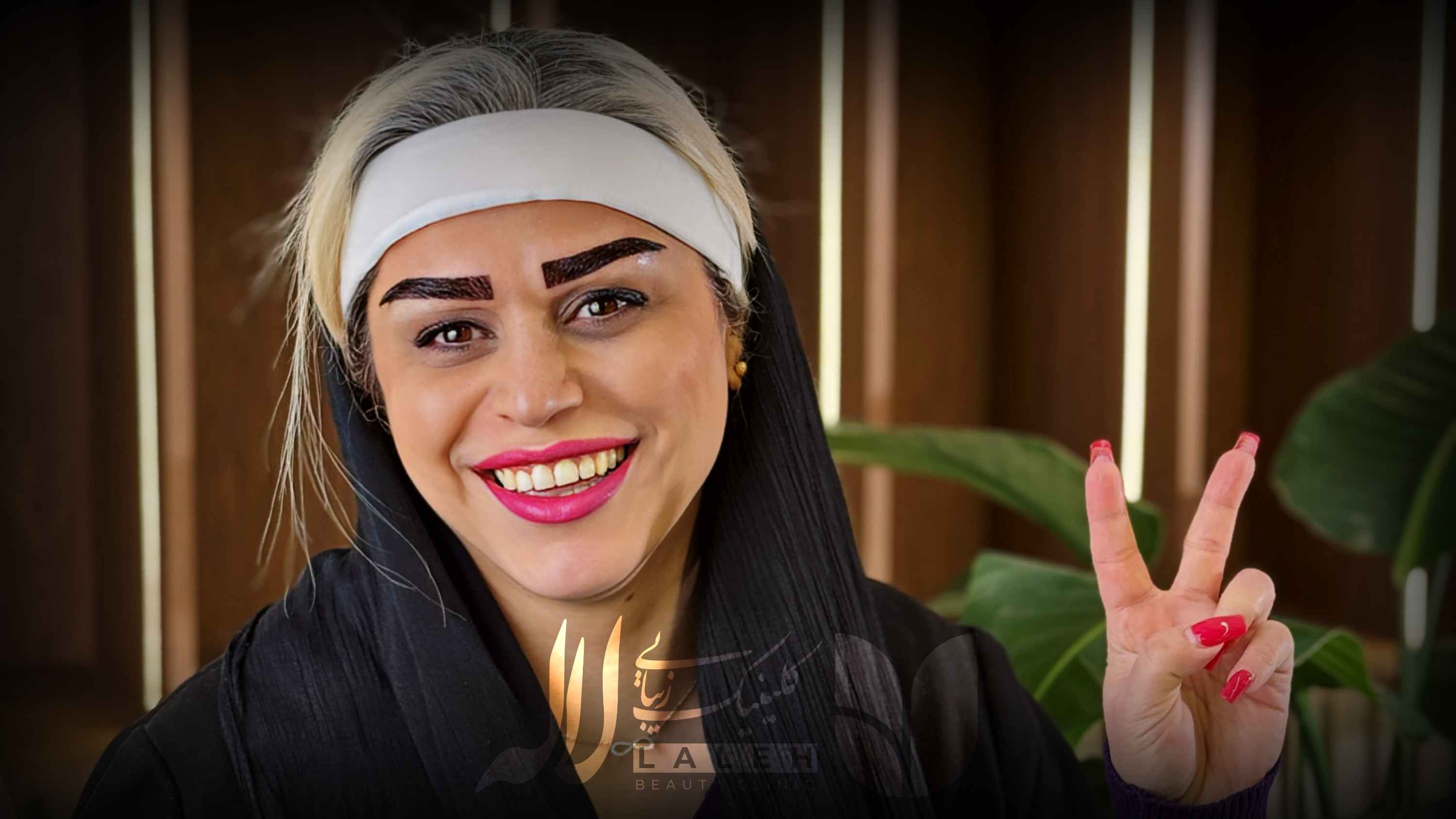 قیمت کاشت ابرو در کلینیک لاله - برسی هزینه های جانبی